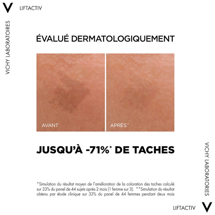 Vichy Liftactiv Specialist B3 Pigmentation & Anti-Wrinkle Serum 30ml (1.01 fl oz)