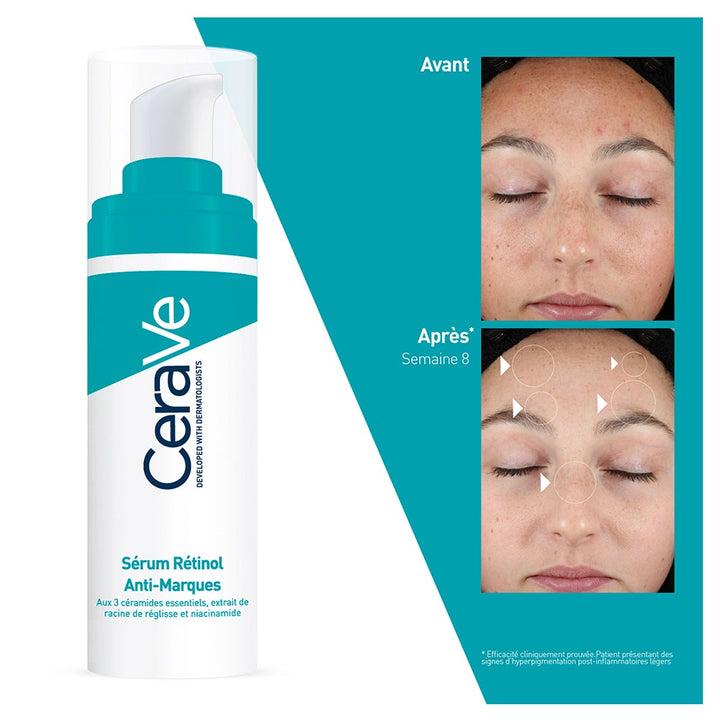 CeraVe Anti-Pigmentation Retinol Serum 30ml (1.01 fl oz)