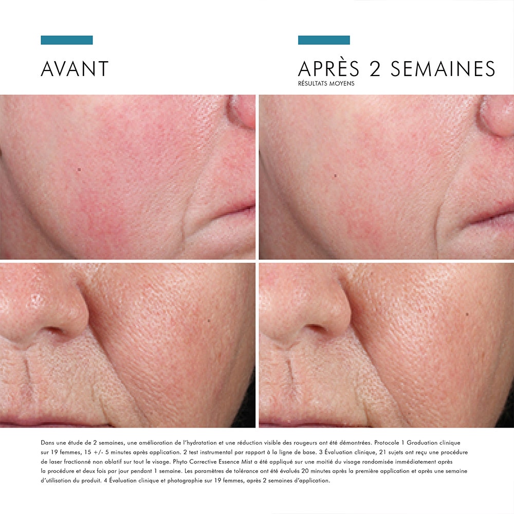 Skinceuticals phyto correctif apaisant l'essence peau sensible 50 ml (1,69fl oz)