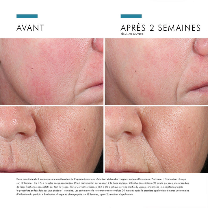 Skinceuticals phyto correctif apaisant l'essence peau sensible 50 ml (1,69fl oz)