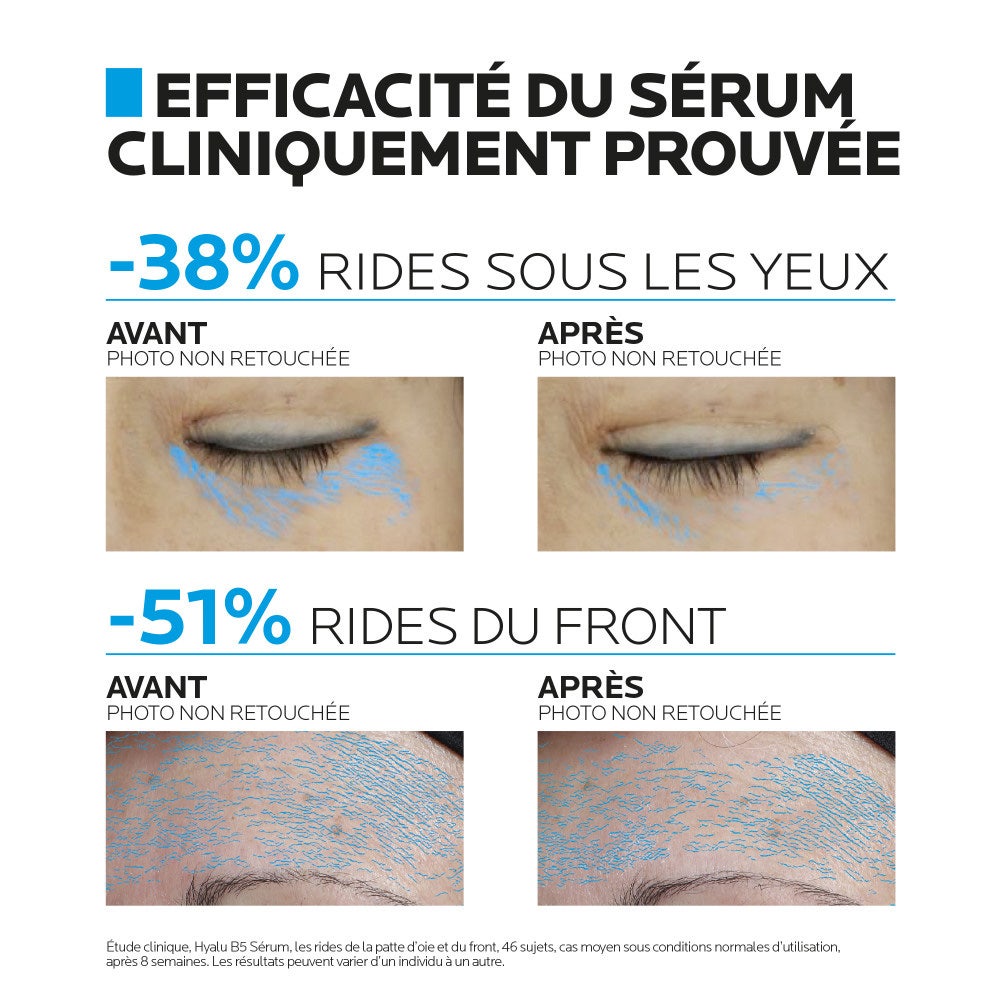 La Roche-Posay Hyalu B5 Anti-Wrinkle Repair Serum + Free Eye Serum 55ml (1.86fl oz)