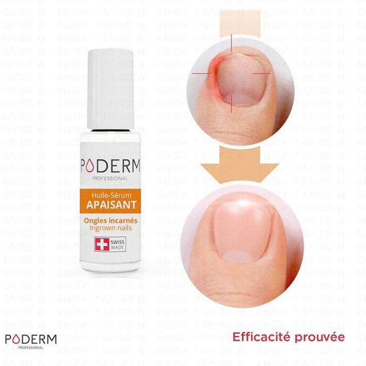 Poderm Soothing Oil Serum For Sensitive Nails 8ml (0.27fl oz)
