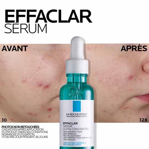 La Roche-Posay Effaclar Ultra Concentrated Serum + Foaming Gel Acne-prone Skin