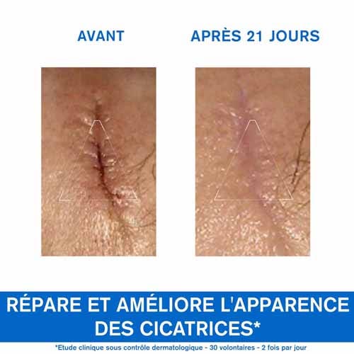 Uriage Bariéderm-Cica Repair Cream fragile skin 100 ml (3.38fl oz)