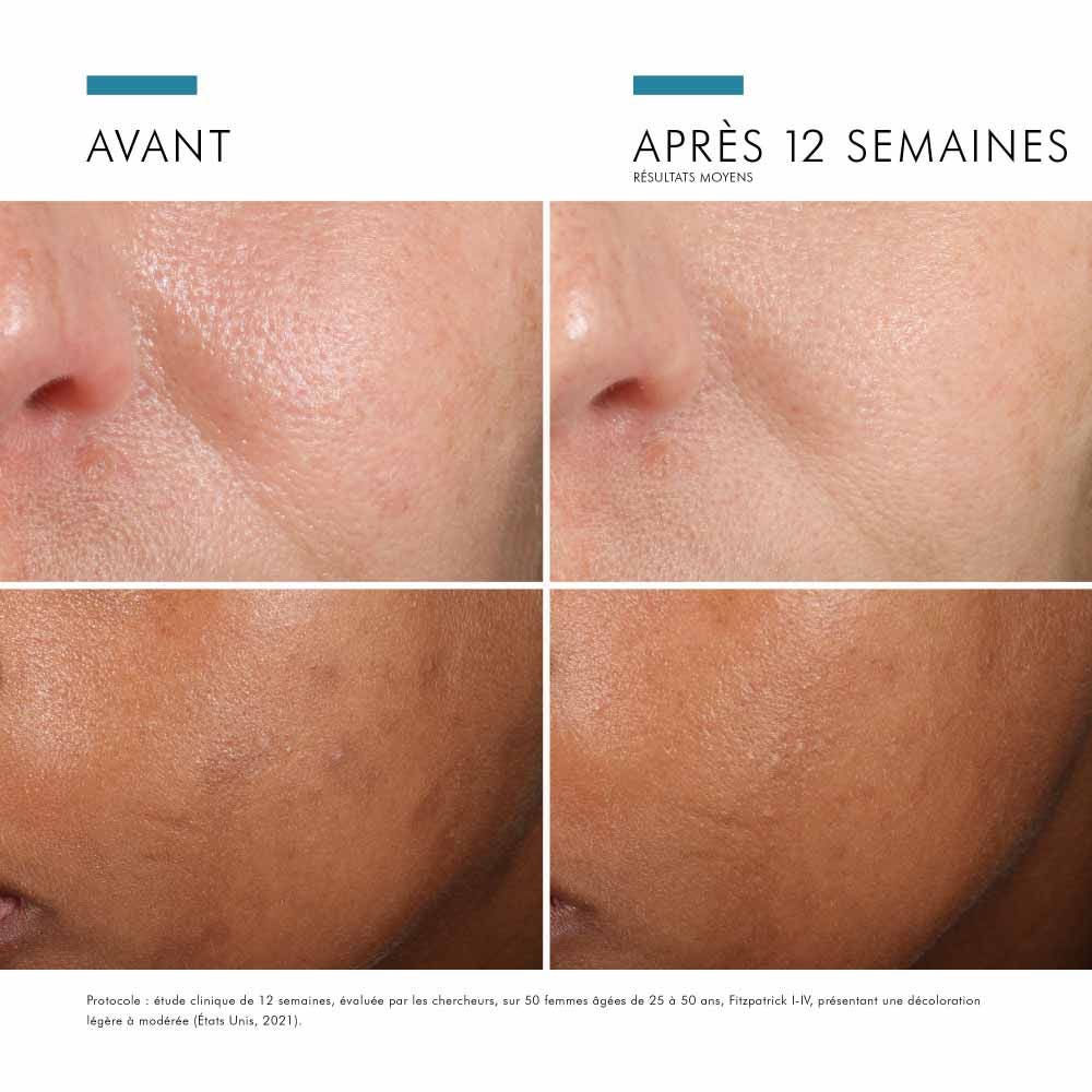 Skinceuticals Prevent Phloretin Cf Antioxydant 30ml (1.01fl oz)