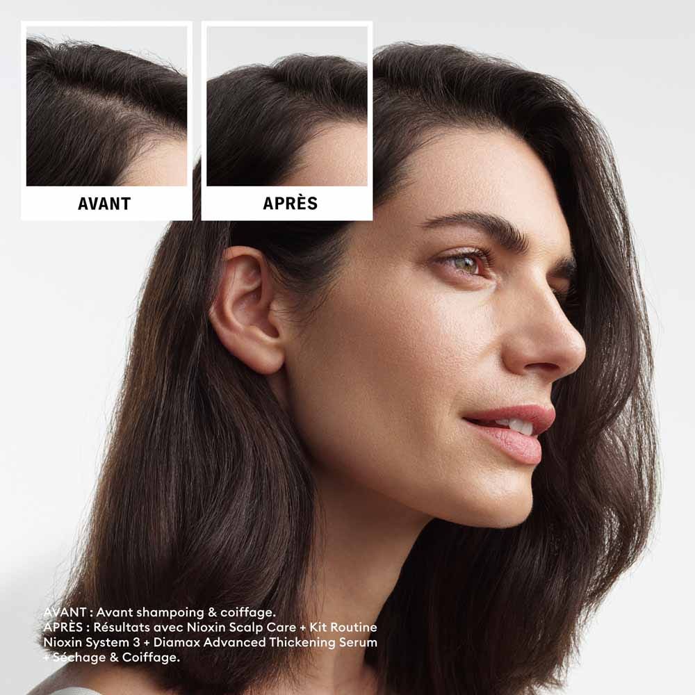 Nioxin System 3 Kit for Dyed/Dry/Damaged Hair and Moderate Loss 700ml (23.67fl oz)
