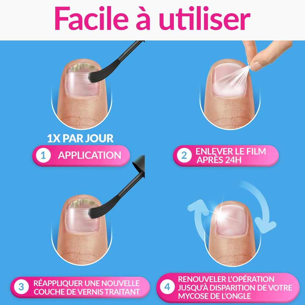 Excilor Treatment of nail fungus Strong 30ml (1.01fl oz)