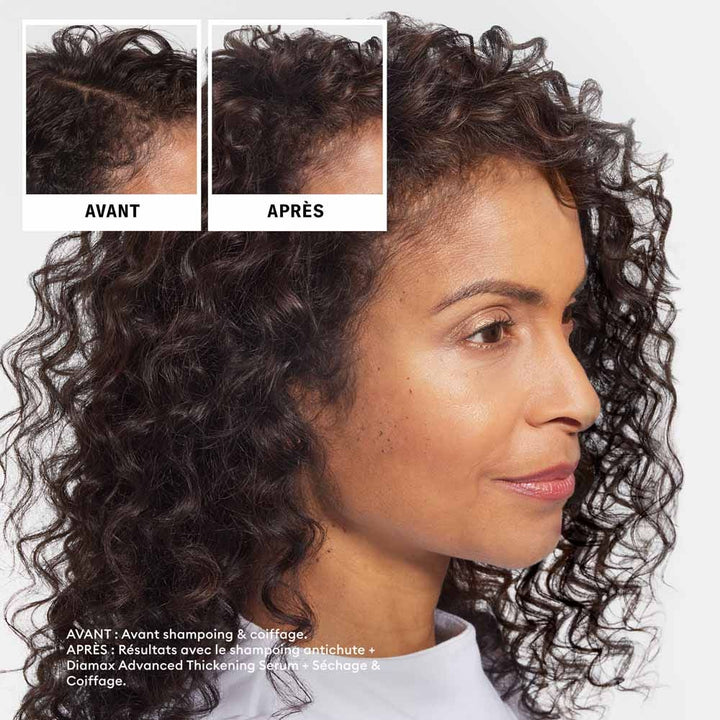 Nioxin Sandalore Anti-Hair Loss Shampoo 240ml (8.12fl oz)
