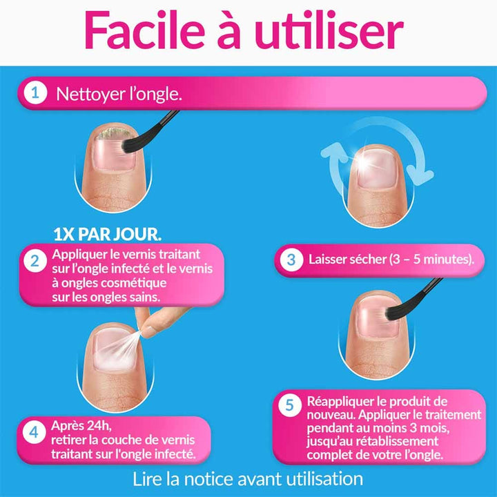 Excilor Nail fungus treatment nude shade 30 ml (1.01fl oz)