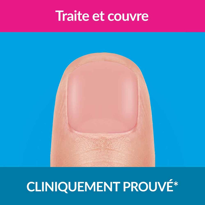 Excilor Nail fungus treatment nude shade 30 ml (1.01fl oz)