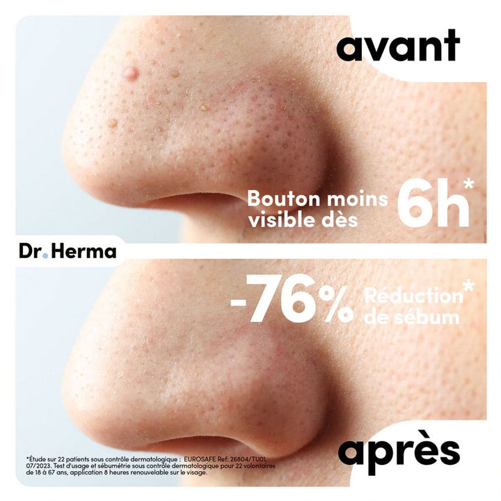 Dr. Herma Anti-spot patch nose patches 2 x 10 units
