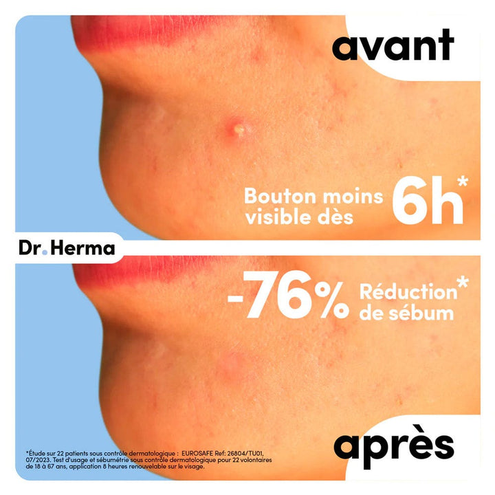 Dr. Herma Anti-Blemish Patch small patches 6 x units