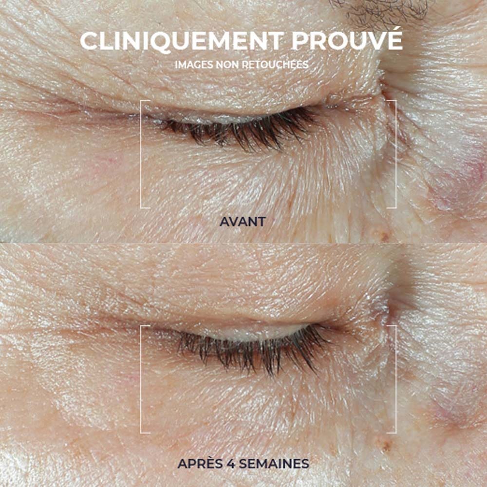 Hydrate ROC + crème pour les yeux dodue 15 ml (0,50fl oz)