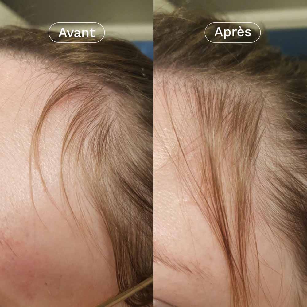 Omum In&Out Hair Duo My Growth Boost 100ml (3.38 fl oz)