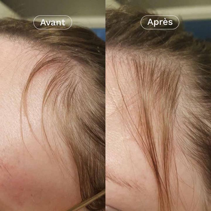 Omum In&Out Hair Duo My Growth Boost 100ml (3.38 fl oz)