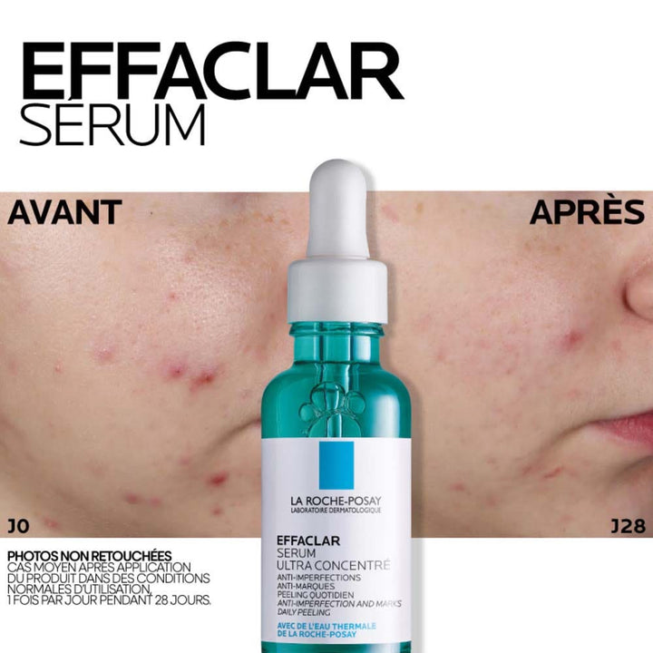 La Roche-Posay Effaclar Blemish Control Face Serum acne-prone skin 30ml (1.01fl oz)