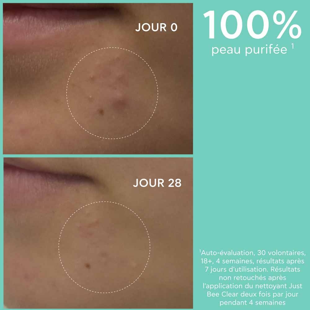 Apivita Just Bee Clear Purifying Cleansing Gel 200ml (6.76fl oz)
