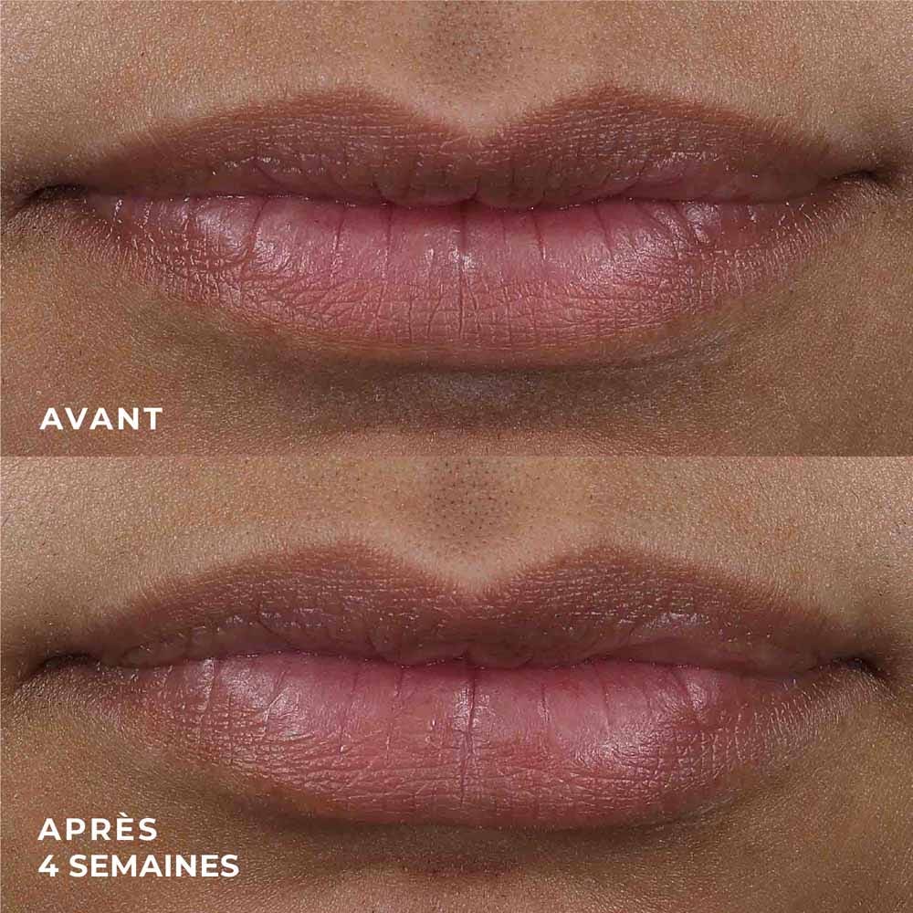 Roc Derm Correxion Volumea Lips 10ml (0.33fl oz)