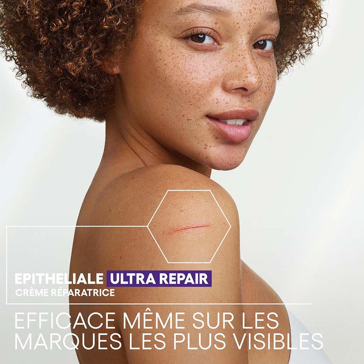 A-Derma Epitheliale A.H Repair Cream for Dark Spots ultra-rich formula 40ml (1.35fl oz)