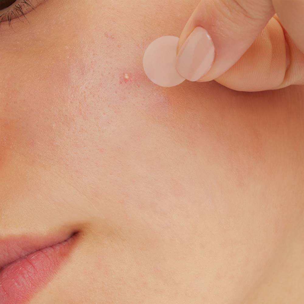 Cerave Anti-Imperfection Patches 22 patches