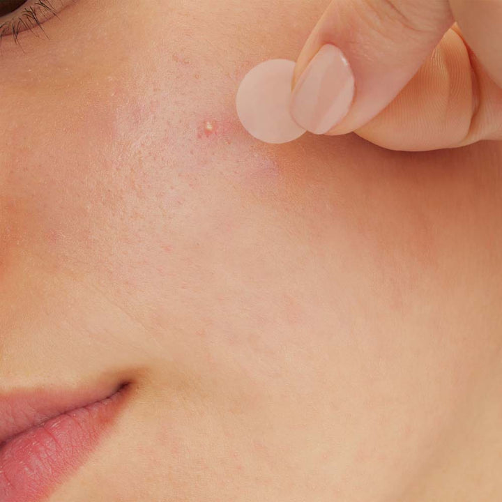 Cerave Anti-Imperfection Patches 22 patches