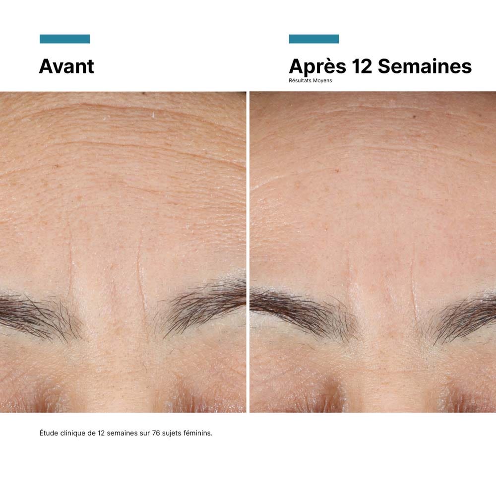 Skinceuticals Advanced RGN-6 Repair Cream 50ml (1.69fl oz)