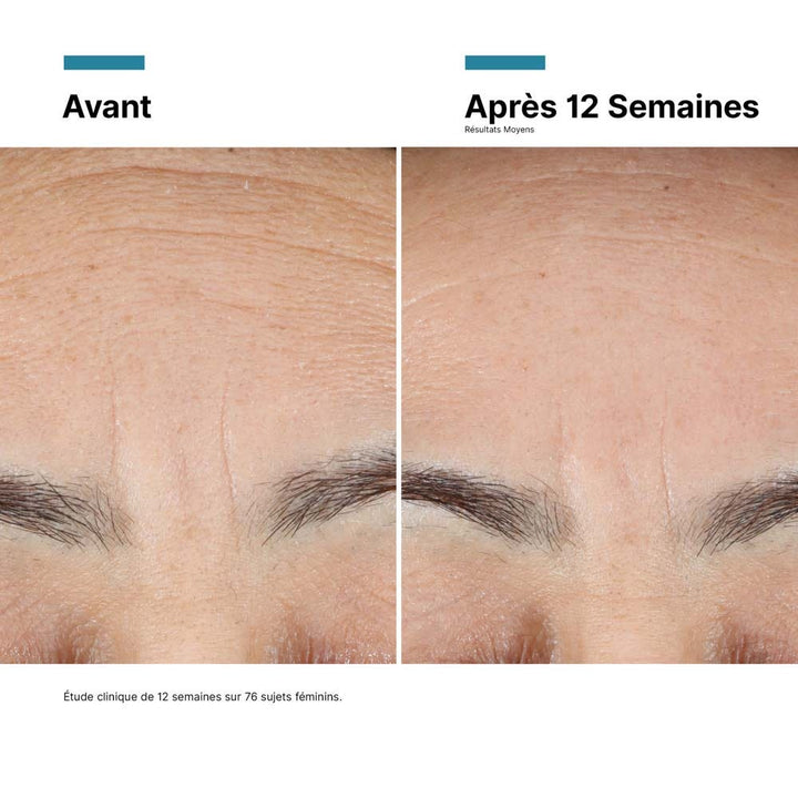 Skinceuticals Advanced RGN-6 Repair Cream 50ml (1.69fl oz)