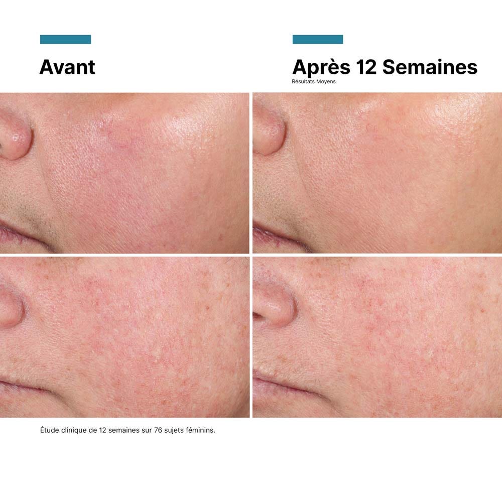 Skinceuticals Advanced RGN-6 Repair Cream 50ml (1.69fl oz)