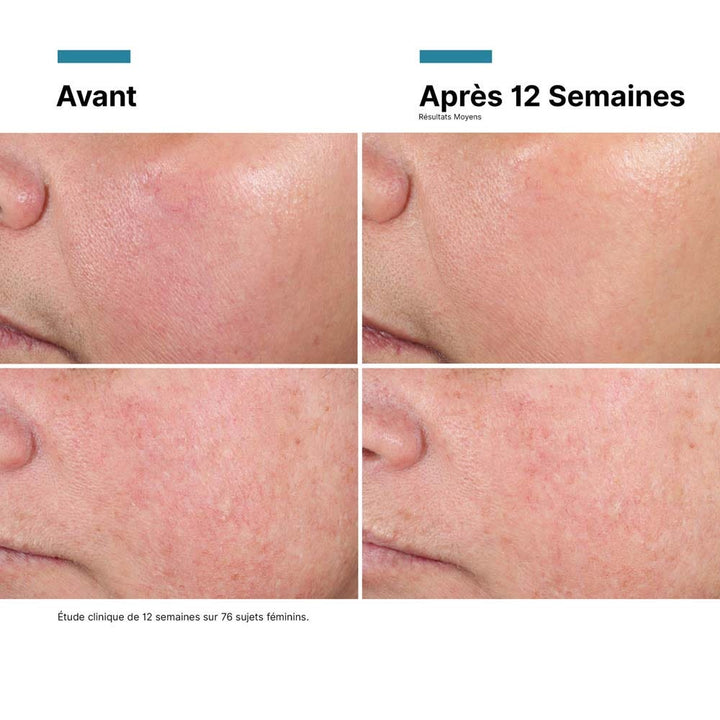 Skinceuticals Advanced RGN-6 Repair Cream 50ml (1.69fl oz)