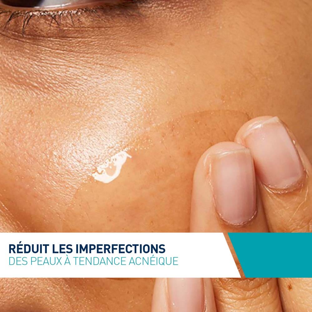 Cerave Anti-Blemish SOS Kit + Free Sticker
