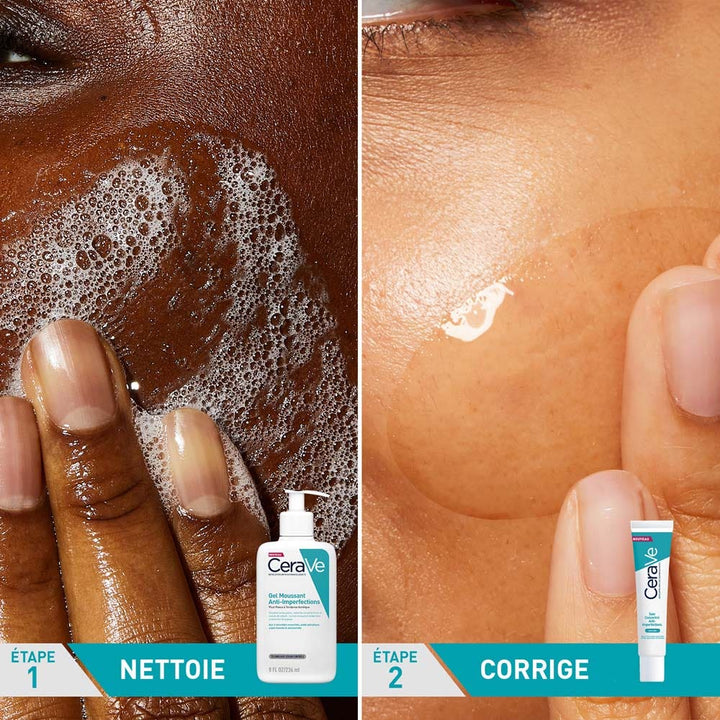 Cerave Anti-Blemish SOS Kit + Free Sticker
