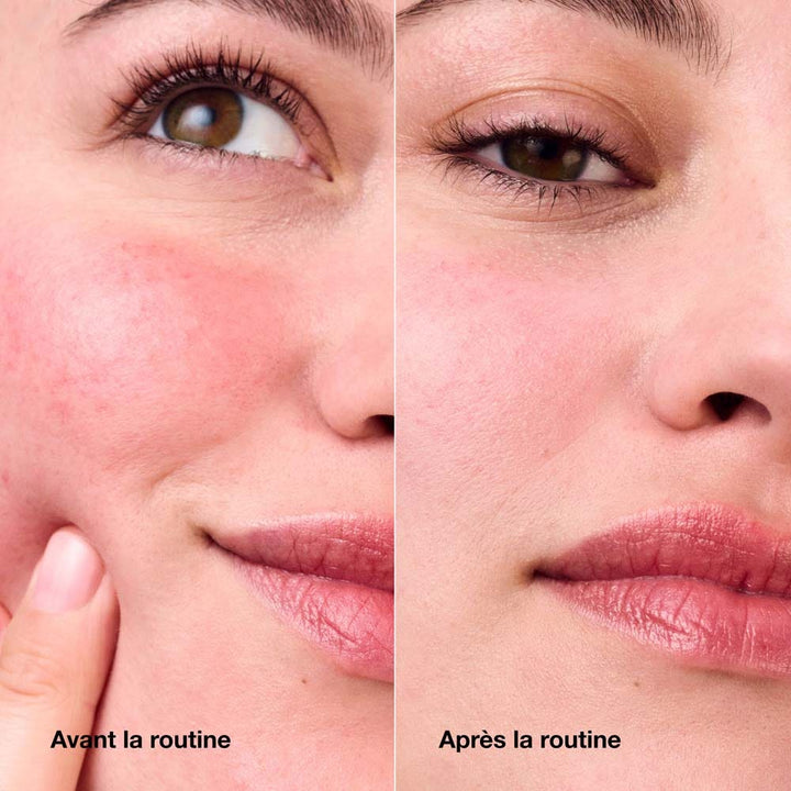 Clinique Redness Solutions Anti-Redness Cream all skin types 50ml (1.69fl oz)