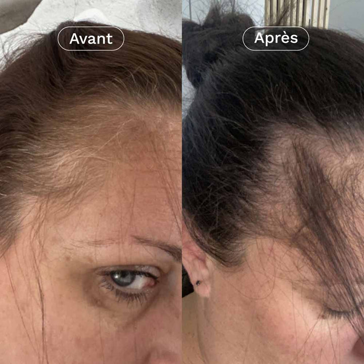 Omum In&Out Hair Duo My Growth Boost 100ml (3.38 fl oz)