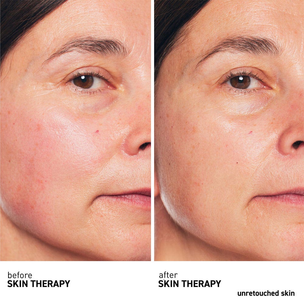Erborian Skin Therapy Multi-Perfecting Night Oil 30ml (1.01fl oz)
