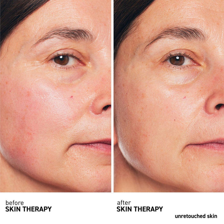 Erborian Skin Therapy Multi-Perfecting Night Oil 30ml (1.01fl oz)