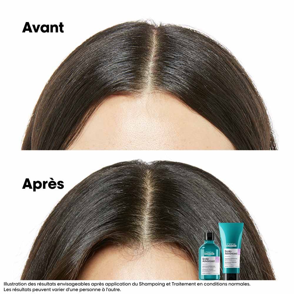 L'Oréal Professionnel Scalp Advanced Refill Soothing dermo-regulating niacinamide shampoo 500ml (16.91fl oz)