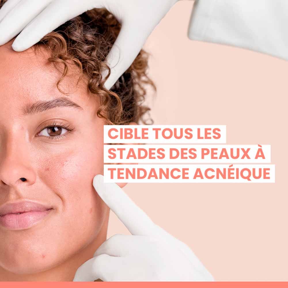 Avène Cleanance Comedomed Intensive serum 30 ml (1.01fl oz)