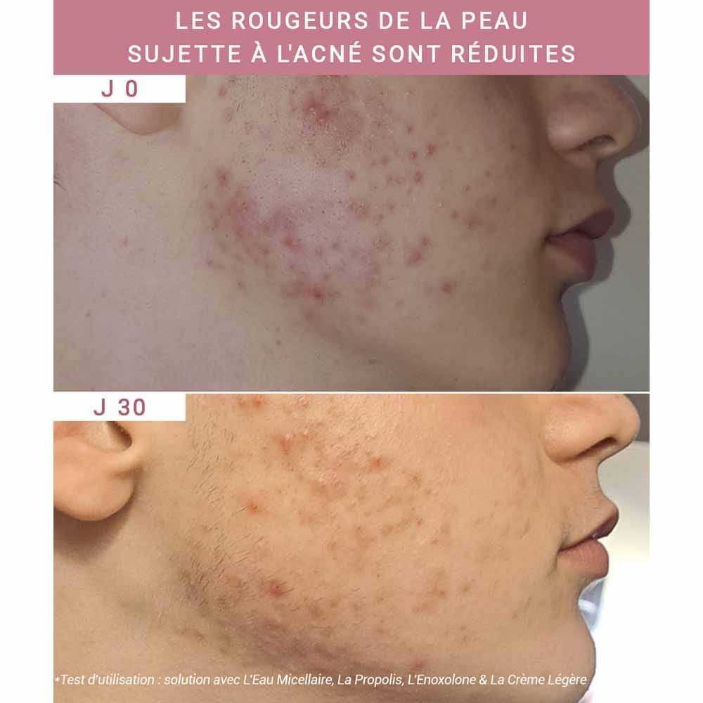 ETAT PUR PURE ENOXOLONE INGRÉDIENTS ACTIVES POUR LES SIGNES RÉACTIVES 15 ML (0,50FL OZ)