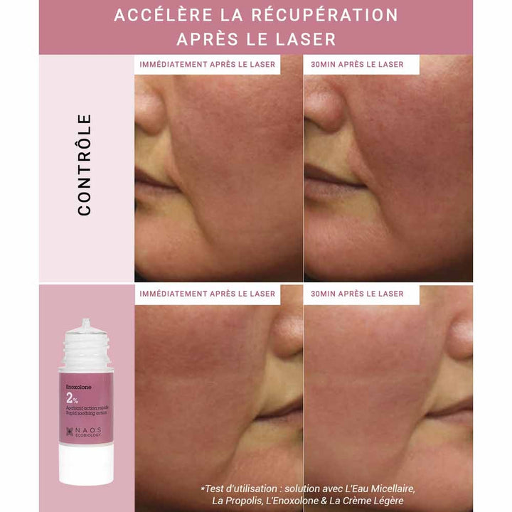 ETAT PUR PURE ENOXOLONE INGRÉDIENTS ACTIVES POUR LES SIGNES RÉACTIVES 15 ML (0,50FL OZ)