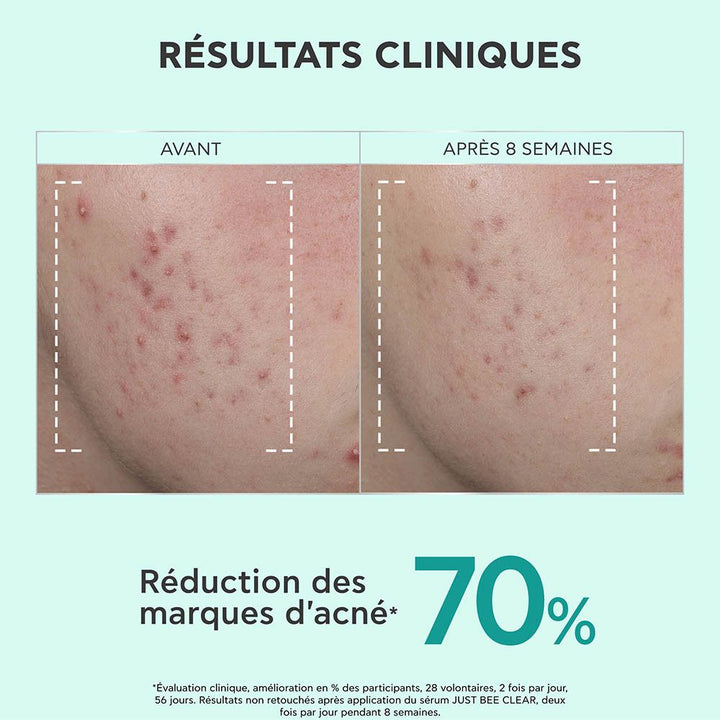 Apivita Just Bee Clear Sérum resurfaçant pour imperfections et marques 30ml