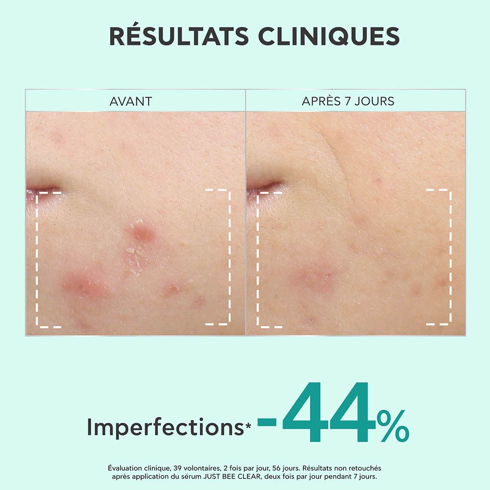 Apivita Just Bee Clear Sérum resurfaçant pour imperfections et marques 30ml
