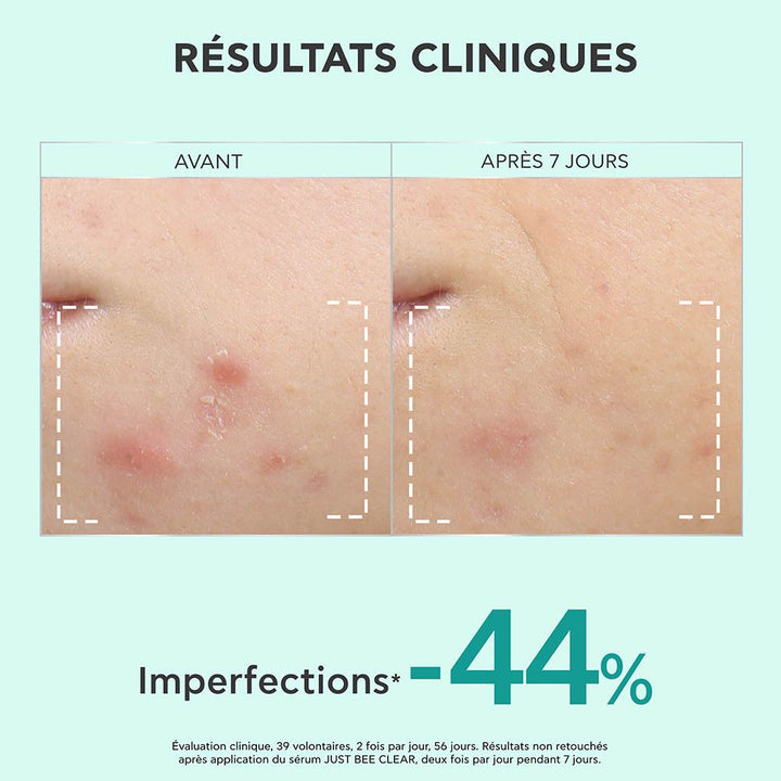 Apivita Just Bee Clear Sérum resurfaçant pour imperfections et marques 30ml