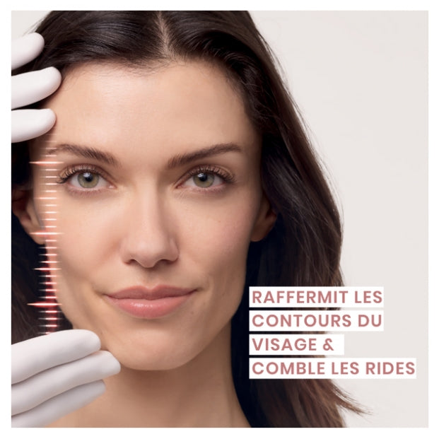 Avène Hyaluron Activ Procedure Rétinal Micro-Lift Eye &amp; Lip Cream 15ml (0.51 fl oz)
