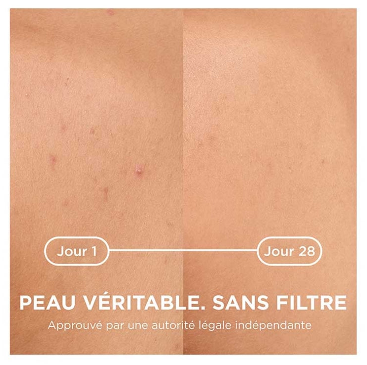 Bioderma Sébium Kerato + Spray anti-imperfecciones 150ml