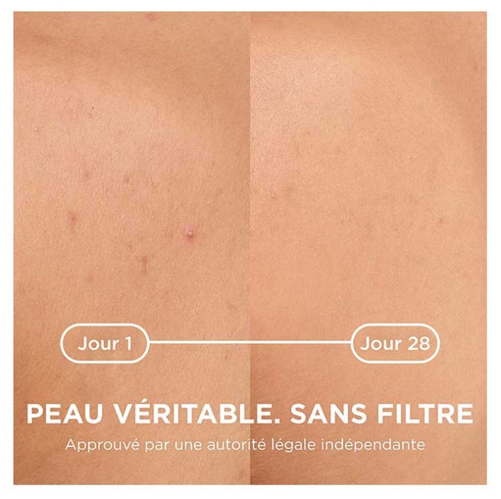 Bioderma Sébium Kerato + Spray anti-imperfecciones 150ml