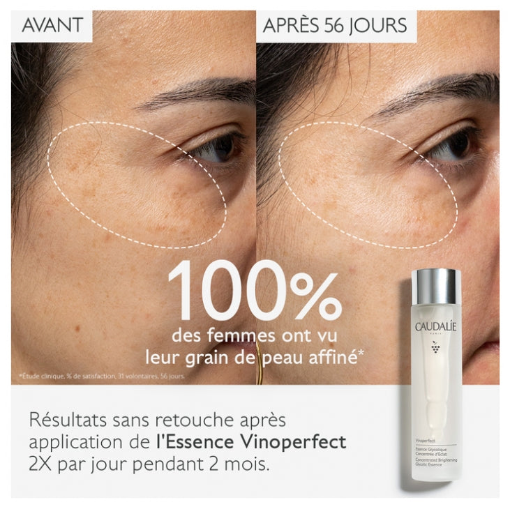 Caudalie Vinoperfect Concentrated Brightening Glycolic Essence 100ml (3.38fl oz)