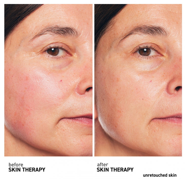 Erborian Skin Therapy Multi-Perfecting Night Oil 30ml (1.01fl oz)