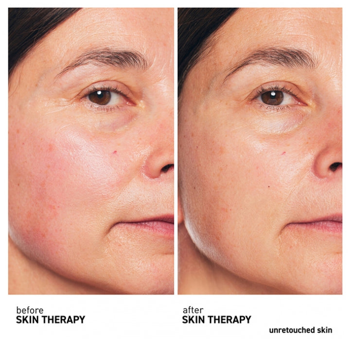 Erborian Skin Therapy Multi-Perfecting Night Oil 30ml (1.01fl oz)