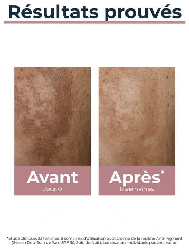 Eucerin Anti-Pigmentation كريم نهاري Spf30 50ml