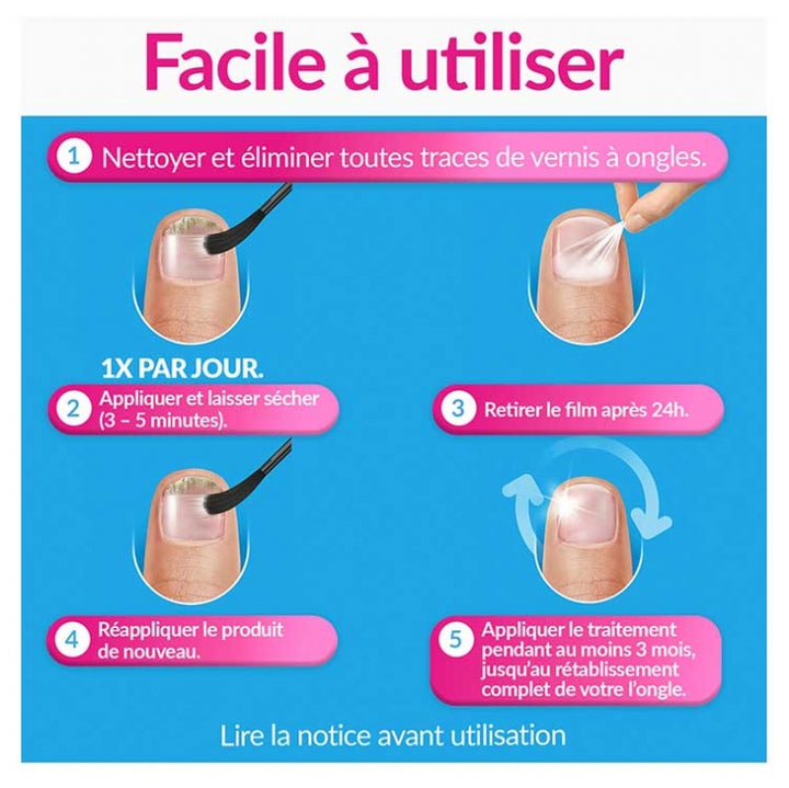 Excilor Treatment of nail fungus Strong 30ml (1.01fl oz)